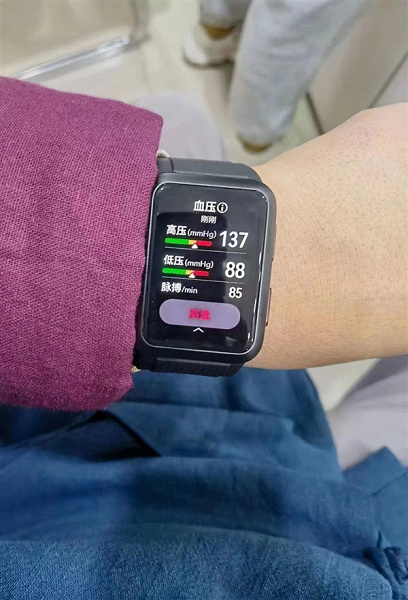 Так выглядят первые умные часы со встроенным тонометром и функцией регистрации ЭКГ. Huawei Watch D «позируют» на живых фото